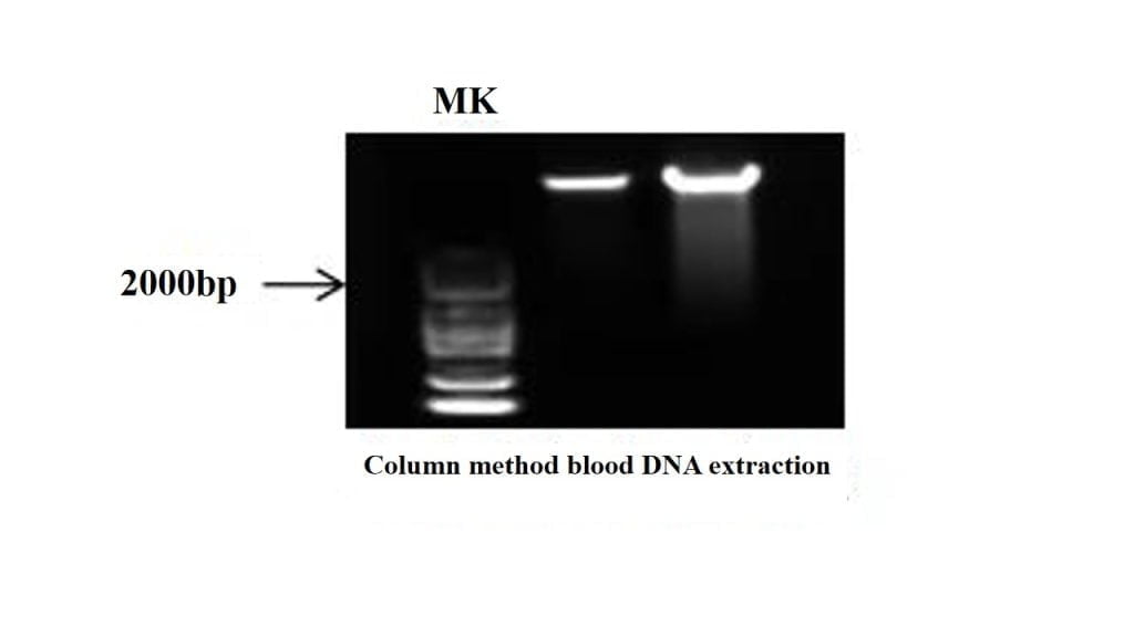 Blood Genomic DNA Extraction Kit - DNA Testing Experts