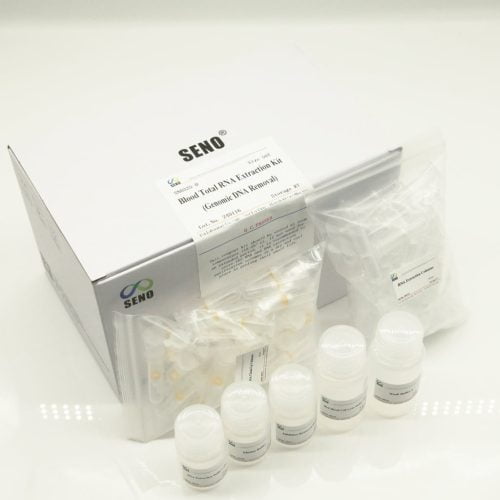 Blut-Gesamt-RNA-Extraktionskit (Entfernung genomischer DNA) – Bild 3