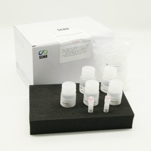Stuhl Total RNA Extraction Kit – Bild 4