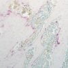 Solarbio Tartrate-Resistant Acid Phosphatase Stain Kit (TRAP Stain Kit)