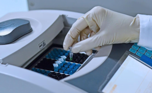 PCR SSCP